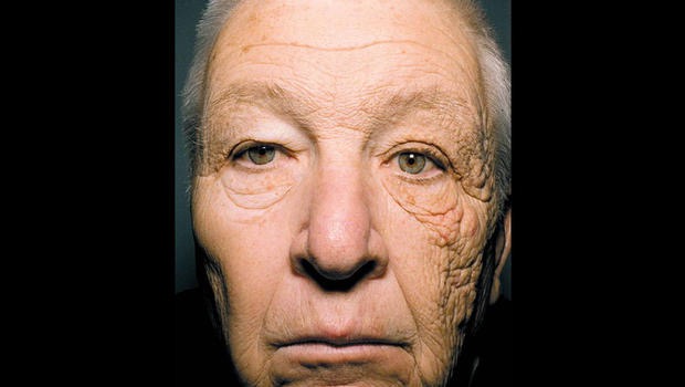 How to Choose a Good Sunscreen, 28 years of truck driving skin damage